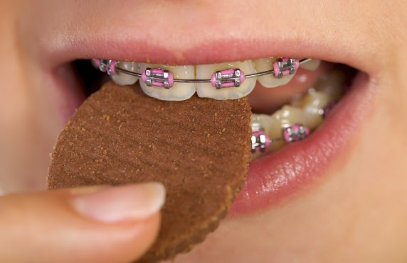 Candies with braces