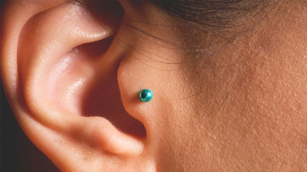 How to Prepare for Tragus Piercing Removal